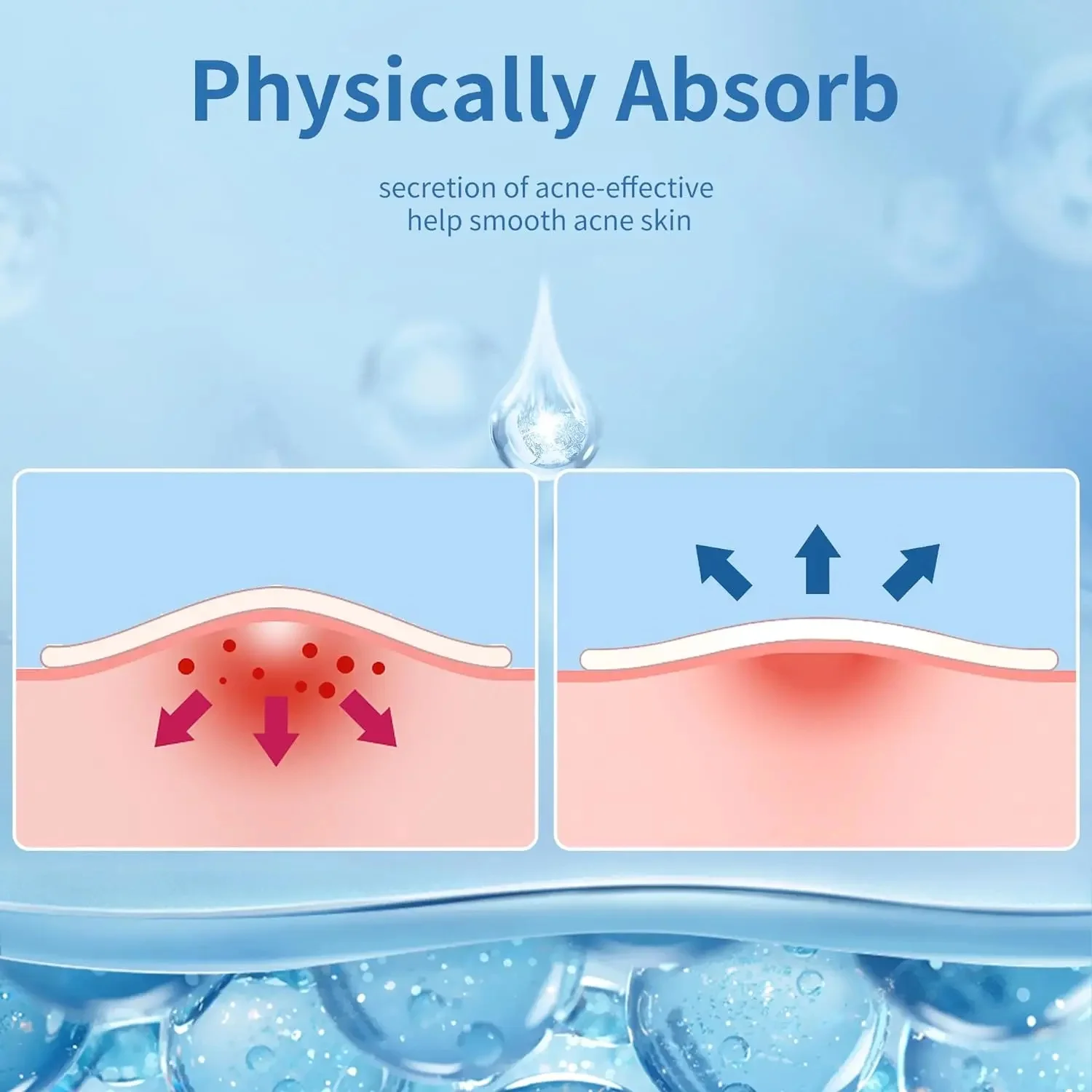 360pcs Face Acne Patch Invisible Skin Care Pimple Acne Patches Anti-inflammatory Healing Absorbing Spot Sticker Covering Acne - Image 5
