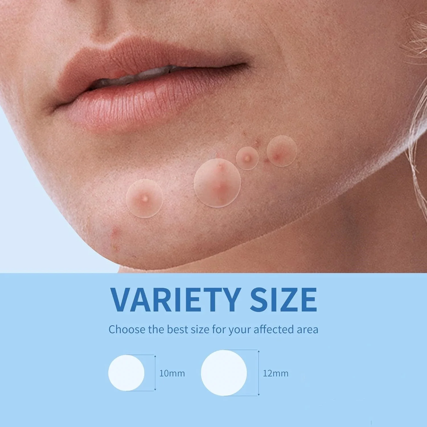 360pcs Face Acne Patch Invisible Skin Care Pimple Acne Patches Anti-inflammatory Healing Absorbing Spot Sticker Covering Acne - Image 6